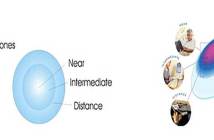 Τι είναι οι πολυεστιακοί φακοί επαφής;