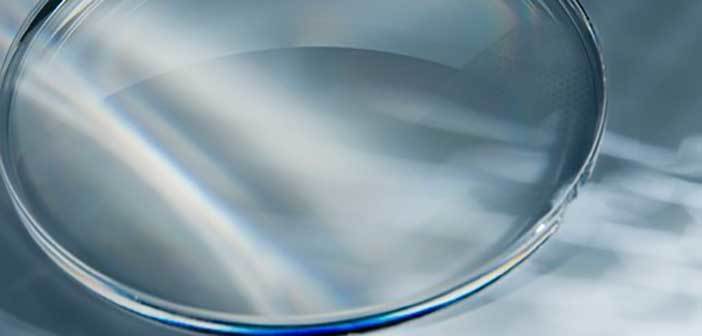 Χαρακτηριστικά των φακών