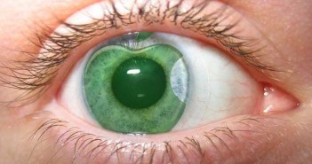 Η ανακοίνωση της Apple: Έρχονται οι έξυπνοι φακοί επαφής