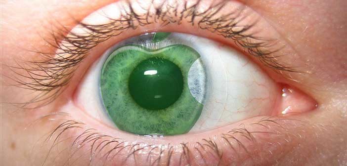 Η ανακοίνωση της Apple: Έρχονται οι έξυπνοι φακοί επαφής