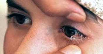 Παιδί κλαίει κρυστάλλινες πέτρες αντί για δάκρυα