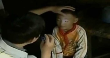 Το παιδί θαύμα: Βλέπει στο απόλυτο σκοτάδι