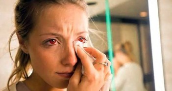 Μην αγοράζετε θεατρικούς φακούς επαφής χωρίς να έχετε ιατρική συνταγή