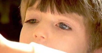 Το τρίχρονο αγόρι που δεν μπορεί να ανοιγοκλείσει τα μάτια του