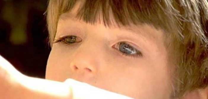 Το τρίχρονο αγόρι που δεν μπορεί να ανοιγοκλείσει τα μάτια του