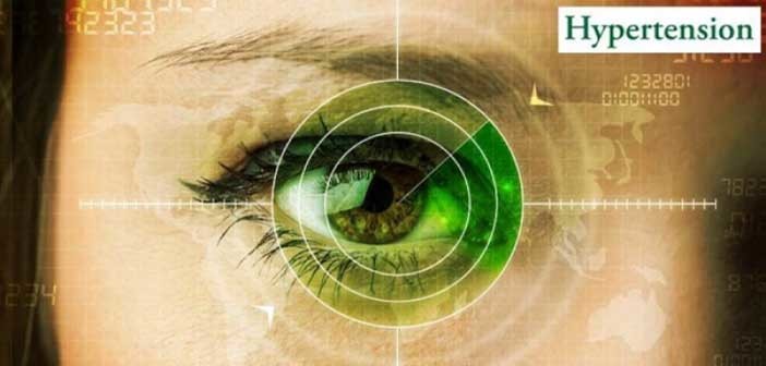 Πως το εγκεφαλικό επεισόδιο φαίνεται από τα… μάτια μας