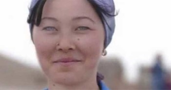 Οι άνθρωποι που διαθέτουν παράξενα μάτια, μαλλιά και δέρμα