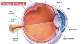 Αποκόλληση Αμφιβληστροειδούς