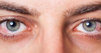 Αλλεργίες της άνοιξης - Κάντε το τεστ