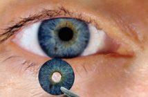 Η πρώτη τεχνητή ίριδα