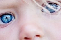 Καταρράκτης στην παιδική ηλικία